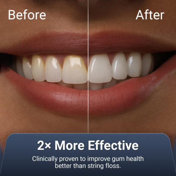 Oral Dental Water Flosser for Teeth | Black - Image 2